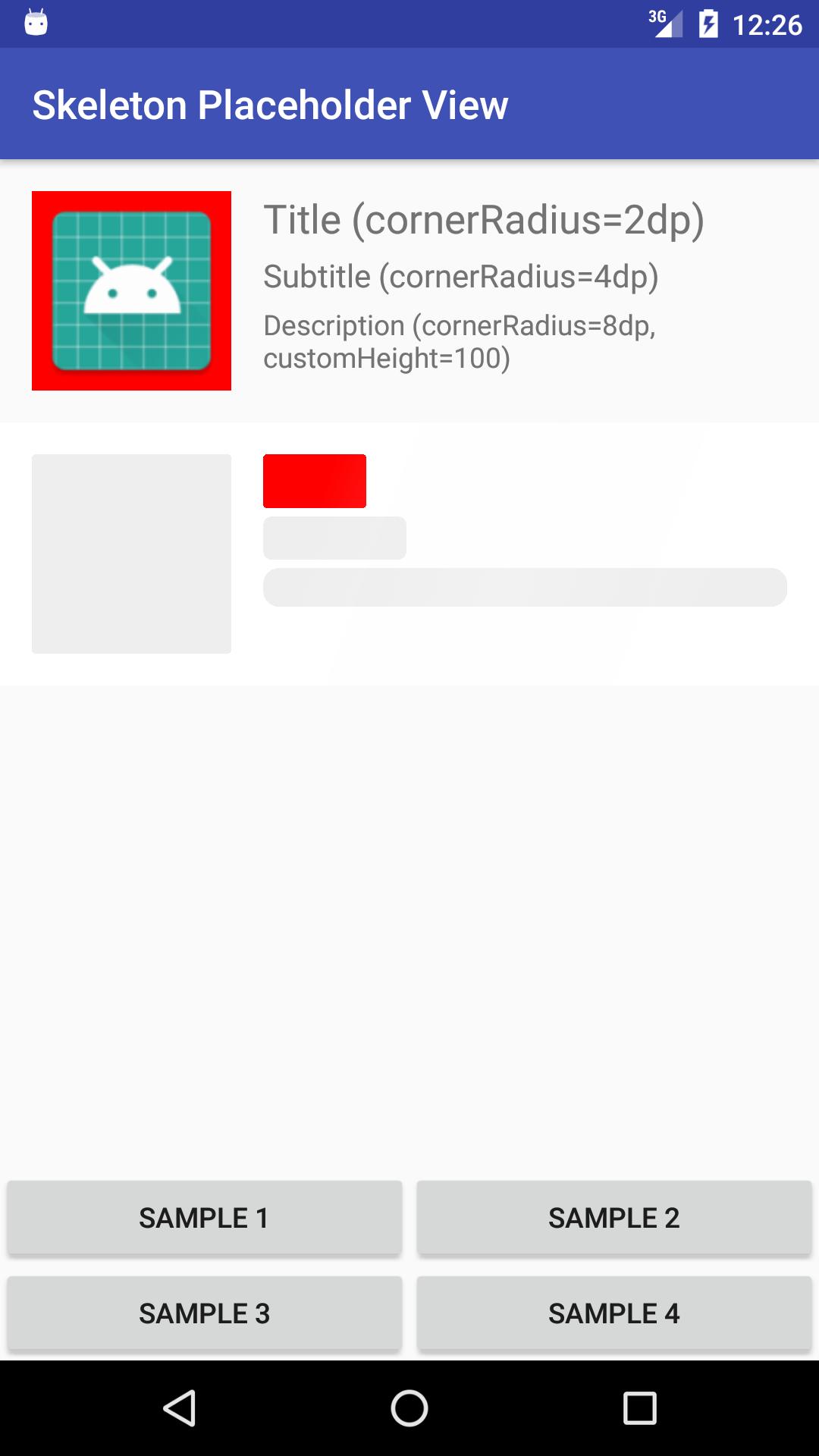 Skeleton Placeholder View