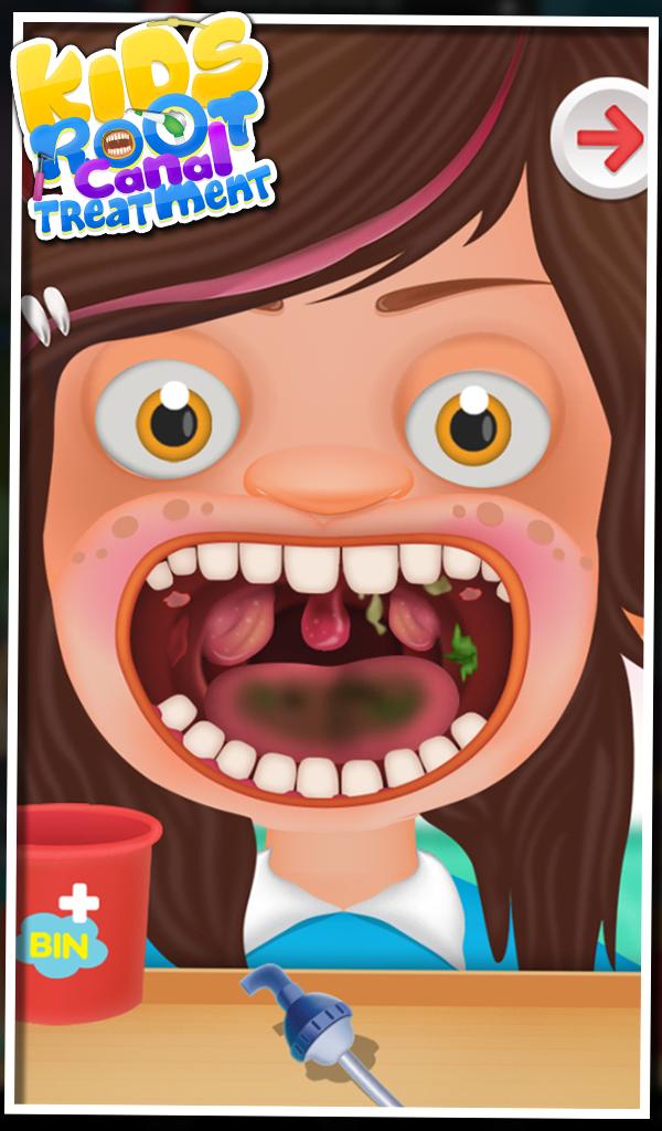 Root Canal Treatment