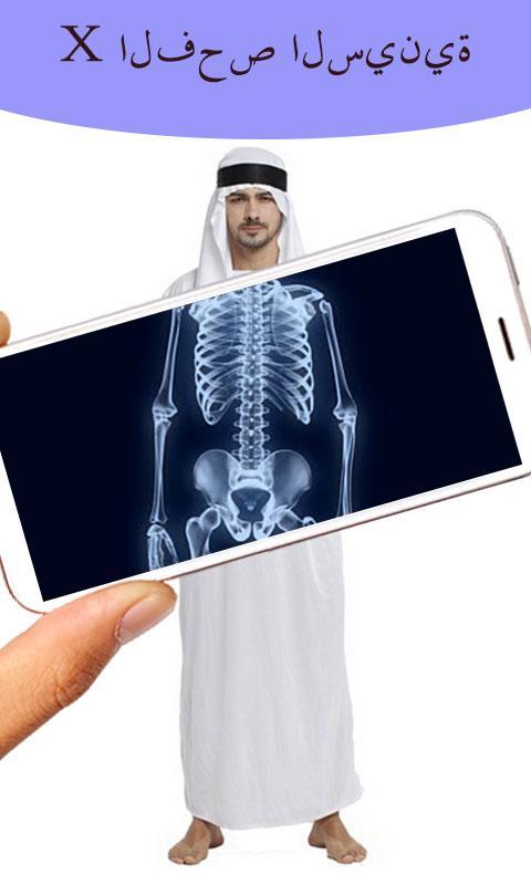 X-ray Bikini Girl Prank